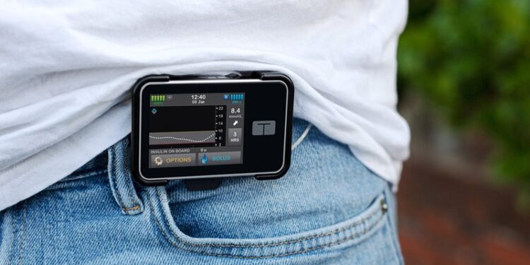 مرضى السكري في القصيم